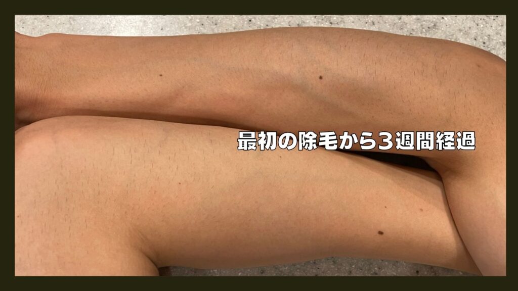 レイボーテヴィーナスレビュー】防水VIO対応で自宅のお風呂で使える